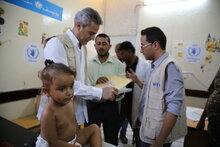紛争地イエメンで飢餓と栄養不良が深刻に
